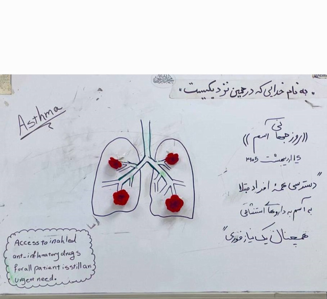 آسم